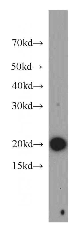 K-562 cells were subjected to SDS PAGE followed by western blot with Catalog No:109467(COPZ1 antibody) at dilution of 1:500