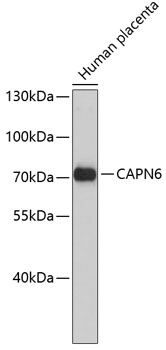 Western blot - CAPN6 Monoclonal Antibody 