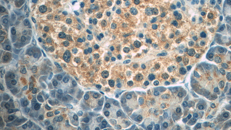 Immunohistochemistry of paraffin-embedded human pancreas tissue slide using Catalog No:107598(SND1 Antibody) at dilution of 1:50 (under 40x lens)