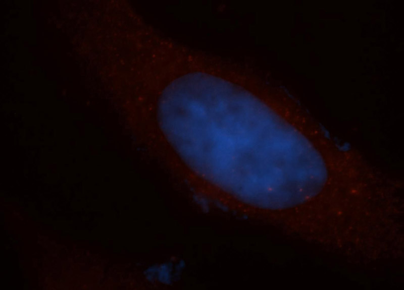 Immunofluorescent analysis of MCF-7 cells, using CCDC28A antibody Catalog No:108971 at 1:50 dilution and Rhodamine-labeled goat anti-rabbit IgG (red). Blue pseudocolor = DAPI (fluorescent DNA dye).