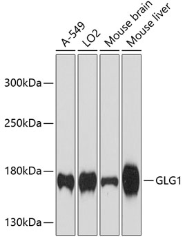 Western blot - GLG1 Polyclonal Antibody 