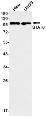 Western blot detection of STAT6 in Hela,U2OS cell lysates using STAT6 Rabbit mAb(1:1000 diluted).Predicted band size:94kDa.Observed band size:94kDa.