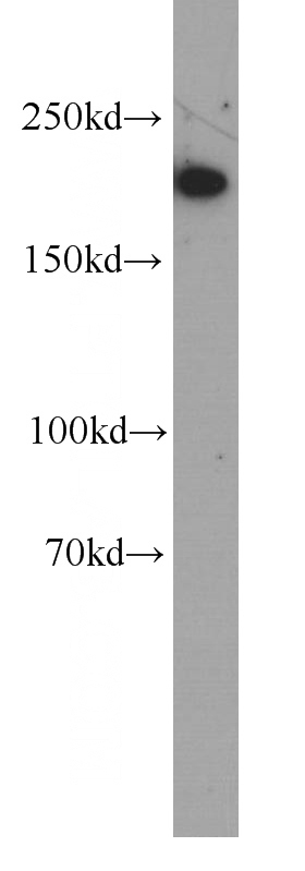 HeLa cells were subjected to SDS PAGE followed by western blot with Catalog No:107591(MYH11 antibody) at dilution of 1:500