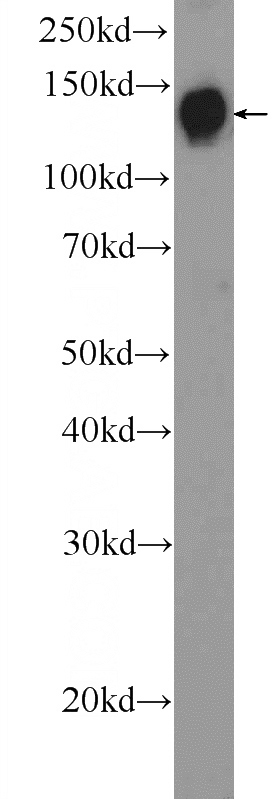 mouse stomach tissue were subjected to SDS PAGE followed by western blot with Catalog No:109889(DENND3 Antibody) at dilution of 1:1000