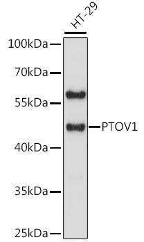 Western blot - PTOV1 Polyclonal Antibody 