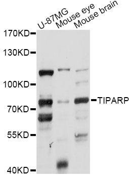 Western blot - TIPARP Polyclonal Antibody 