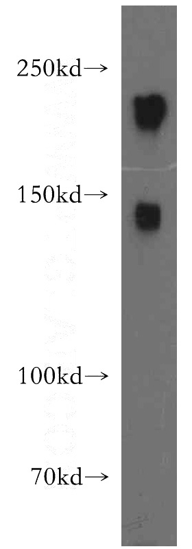 mouse brain tissue were subjected to SDS PAGE followed by western blot with Catalog No:113148(NEFH antibody) at dilution of 1:500