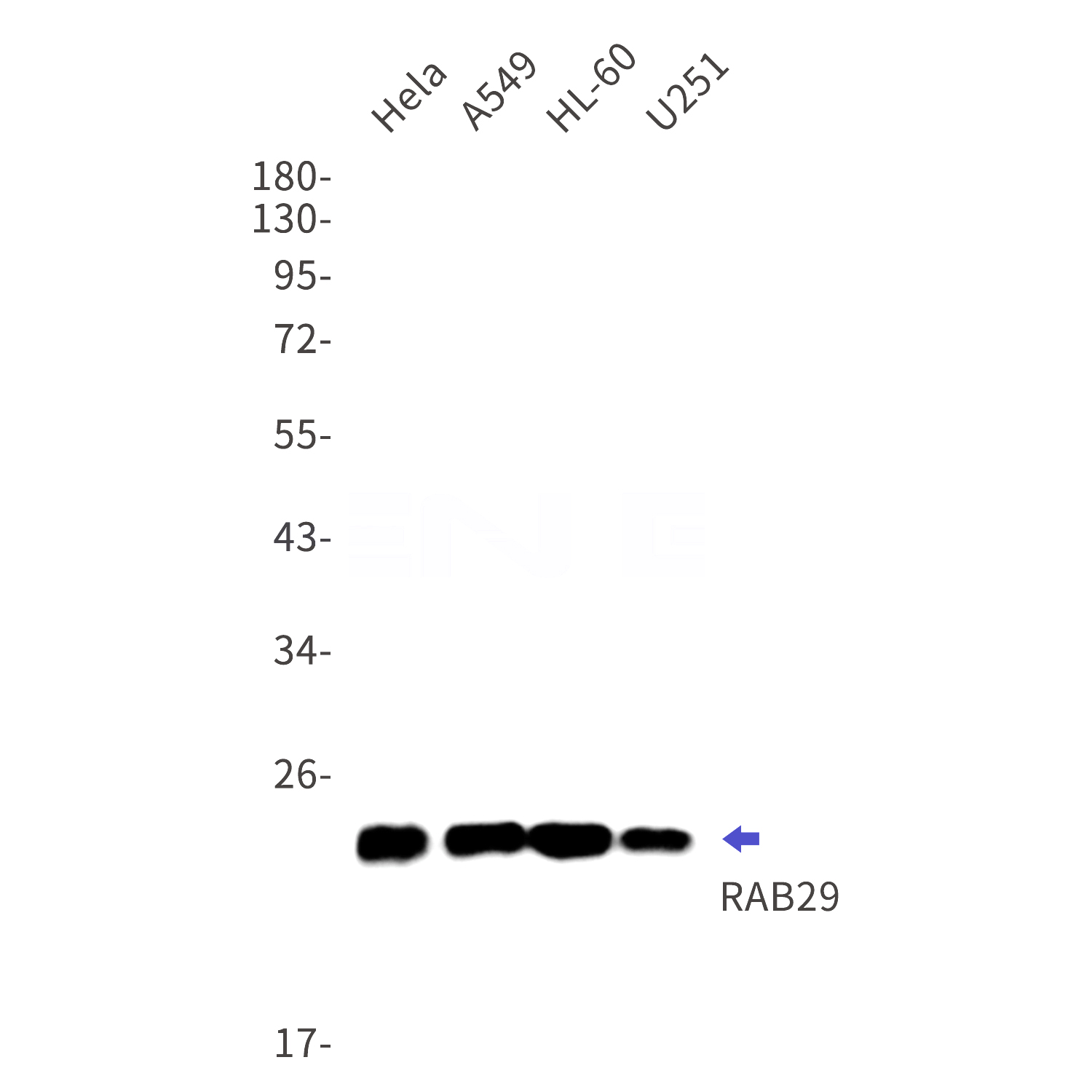 Western blot detection of RAB29 in Hela,A549,HL-60,U251 cell lysates using RAB29 Rabbit mAb(1:1000 diluted).Predicted band size:23kDa.Observed band size:23kDa.