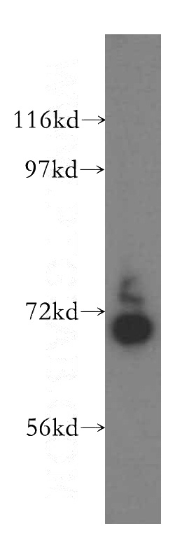 human liver tissue were subjected to SDS PAGE followed by western blot with Catalog No:112316(LRCH3 antibody) at dilution of 1:500