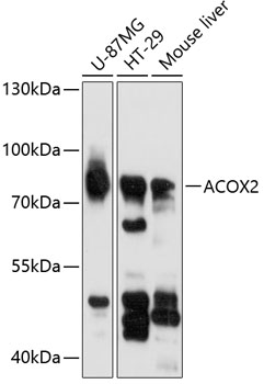 Western blot - ACOX2 Polyclonal Antibody 
