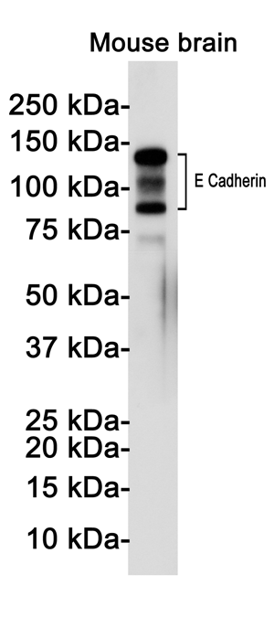 Western blot detection of E Cadherin in Mouse brain lysates using E Cadherin Rabbit pAb(1:1000 diluted).Predicted band size:98(cleavages),135KDa.Observed band size: 80-120(cleavages),135KDa.
