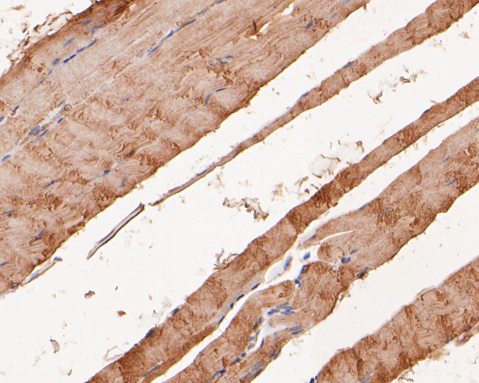 Fig3:; Immunohistochemical analysis of paraffin-embedded rat smooth muscle tissue using anti-KCNQ4 antibody. The section was pre-treated using heat mediated antigen retrieval with Tris-EDTA buffer (pH 8.0-8.4) for 20 minutes.The tissues were blocked in 5% BSA for 30 minutes at room temperature, washed with ddH; 2; O and PBS, and then probed with the primary antibody ( 1/200) for 30 minutes at room temperature. The detection was performed using an HRP conjugated compact polymer system. DAB was used as the chromogen. Tissues were counterstained with hematoxylin and mounted with DPX.