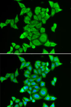 Immunofluorescence - STRN3 Polyclonal Antibody 