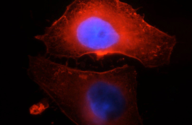 Immunofluorescent analysis of HepG2 cells, using beta actin antibody Catalog No: at 1:200 dilution and Rhodamine-labeled goat anti-mouse IgG (red). Blue pseudocolor = DAPI (fluorescent DNA dye).