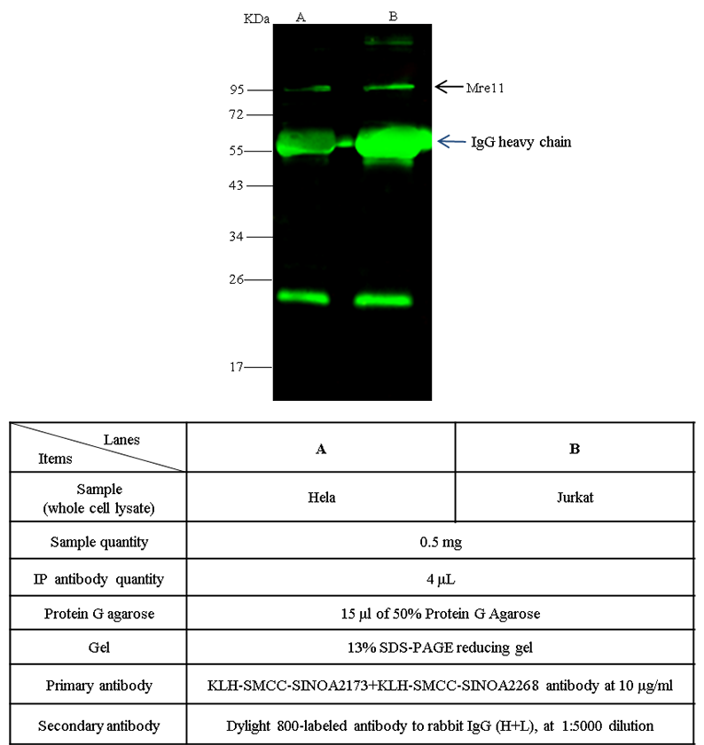 Human MRE11A Immunoprecipitation(IP) 14653