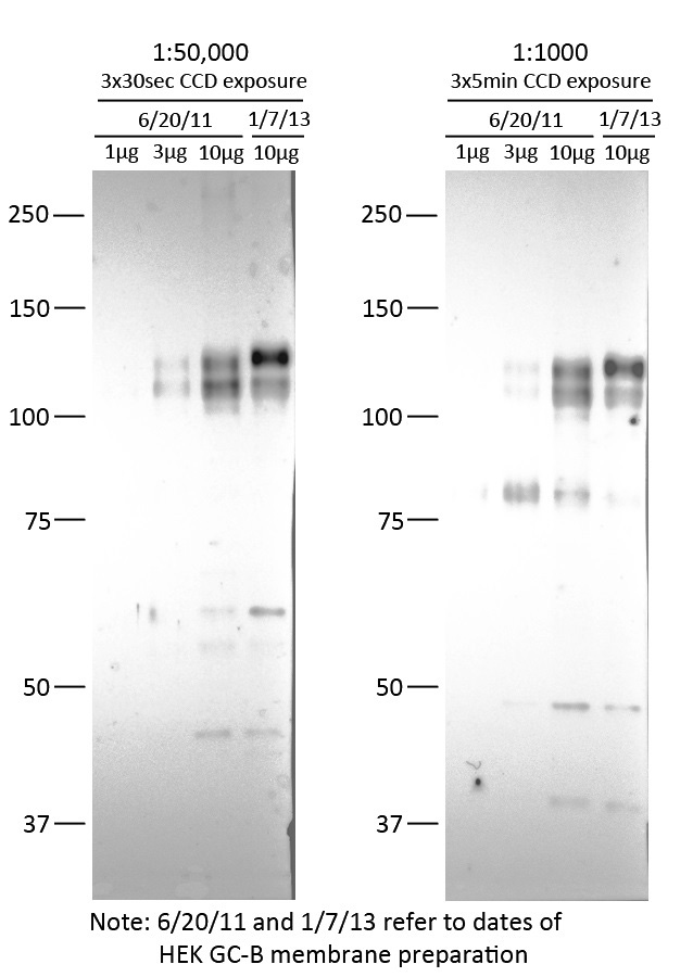 WB result of anti-NPR2 (Catalog No:113220, 1:1000) with HEK293 overexpressed NPR2 by Jeremy Egbert and Laurinda Jaffe. (Another anti serum 6328 as control)