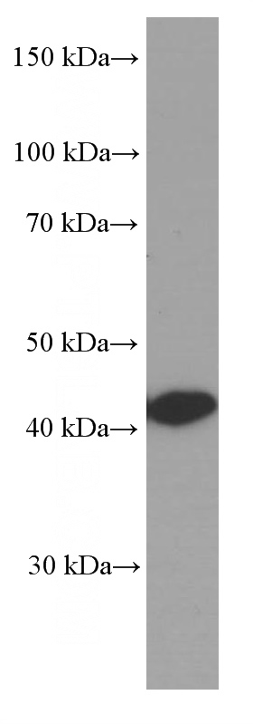 Jurkat cells were subjected to SDS PAGE followed by western blot with Catalog No:107301(Glutamine synthetase Antibody) at dilution of 1:4000
