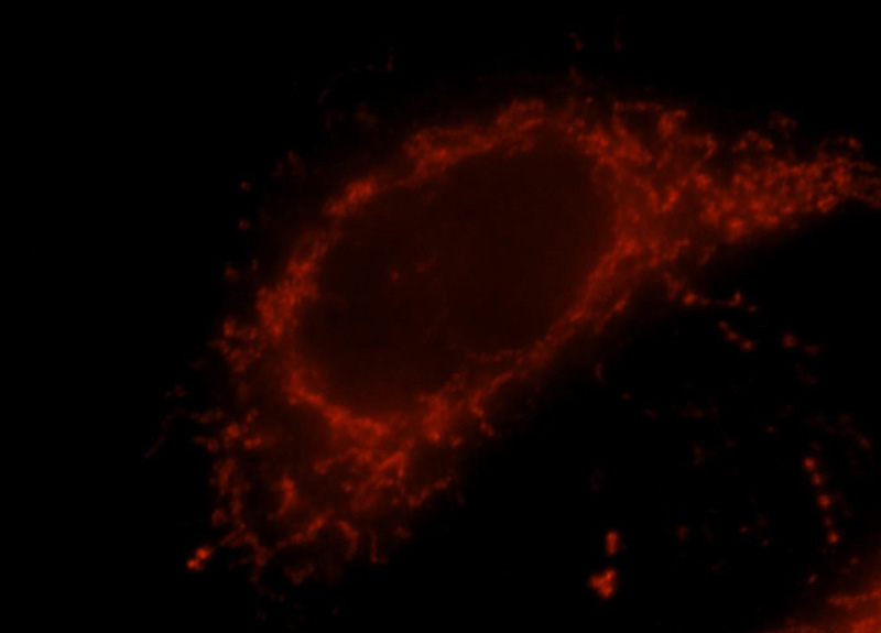 Immunofluorescent analysis of Hela cells, using MAVS antibody Catalog No:112499 at 1:25 dilution and Rhodamine-labeled goat anti-rabbit IgG (red).