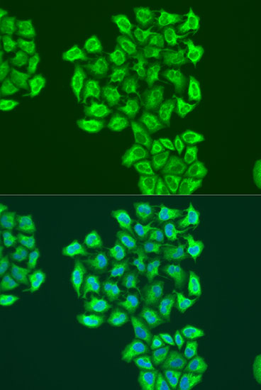 Immunofluorescence - BNIP3 Polyclonal Antibody 