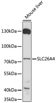 Western blot - SLC26A4 Polyclonal Antibody 