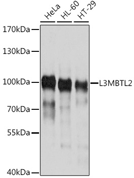 Western blot - L3MBTL2 Polyclonal Antibody 