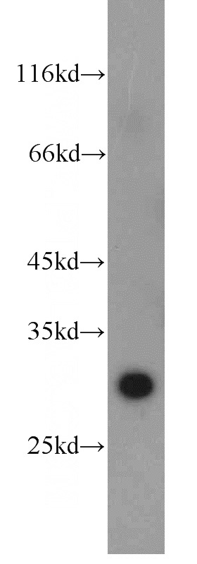 human liver tissue were subjected to SDS PAGE followed by western blot with Catalog No:114380(PSMB10 antibody) at dilution of 1:300