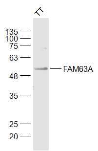Fig1: Sample:; TT(Human) Cell Lysate at 30 ug; Primary: Anti-FAM63A at 1/1000 dilution; Secondary: IRDye800CW Goat Anti-Rabbit IgG at 1/20000 dilution; Predicted band size: 52 kD; Observed band size: 52 kD