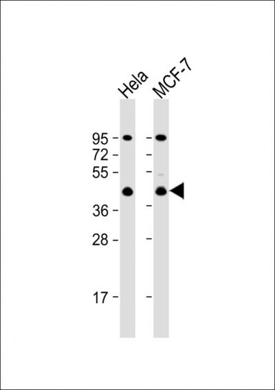 All lanes: Anti-ACTR2 Antibody (C-term) at 1:1000 dilutionnLane 1: Hela whole cell lysatenLane 2: MCF-7 whole cell lysatennLysates/proteins at 20 u03bcg per lane. nnSecondarynGoat Anti-Rabbit IgG,  (H+L), Peroxidase conjugated at 1/10000 dilution. nnPredicted band size: 45 kDannBlocking/Dilution buffer: 5% NFDM/TBST.