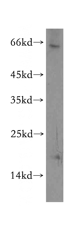 HEK-293 cells were subjected to SDS PAGE followed by western blot with Catalog No:116456(TXNL4B antibody) at dilution of 1:500