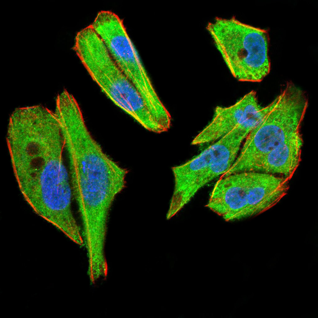 Fig3: ICC staining TBCC (green) and Actin filaments (red) in Hela cells. The nuclear counter stain is DAPI (blue). Cells were fixed in paraformaldehyde, permeabilised with 0.25% Triton X100/PBS.