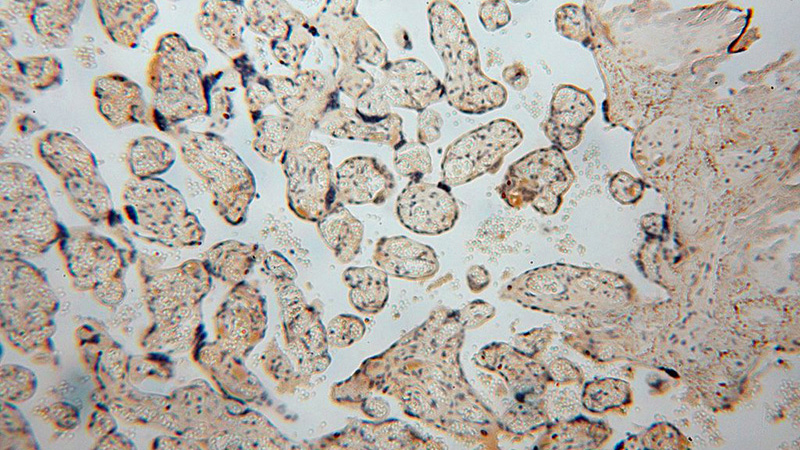 Immunohistochemical of paraffin-embedded human placenta using Catalog No:116487(TUBGCP4 antibody) at dilution of 1:100 (under 10x lens)
