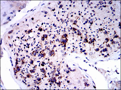 Immunohistochemical analysis of paraffin-embedded testis tissues using NQO1 mouse mAb with DAB staining.