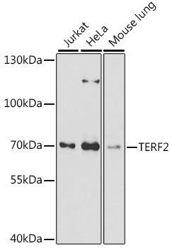 Western blot - TERF2 Polyclonal Antibody 