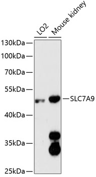 Western blot - SLC7A9 Polyclonal Antibody 