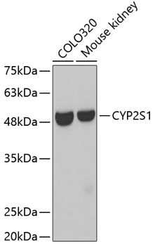 Western blot - CYP2S1 Polyclonal Antibody 