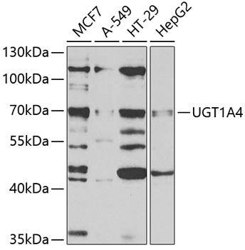 Western blot - UGT1A4 Polyclonal Antibody 