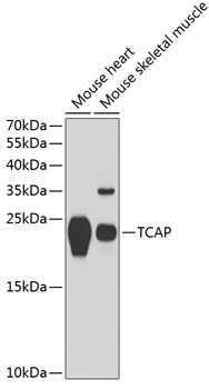 Western blot - TCAP Polyclonal Antibody 