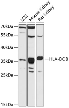 Western blot - HLA-DOB Polyclonal Antibody 
