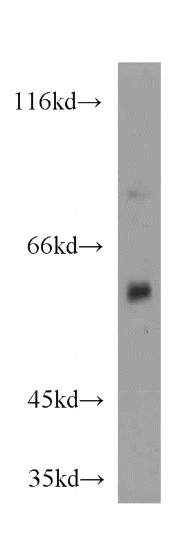 mouse kidney tissue were subjected to SDS PAGE followed by western blot with Catalog No:109703(CYP4A11 antibody) at dilution of 1:200