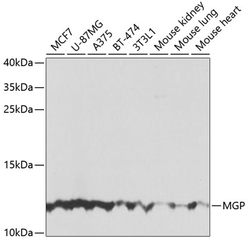 Western blot - MGP Polyclonal Antibody 