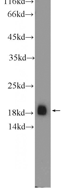 mouse brain tissue were subjected to SDS PAGE followed by western blot with Catalog No:116705(VAMP2 Antibody) at dilution of 1:600