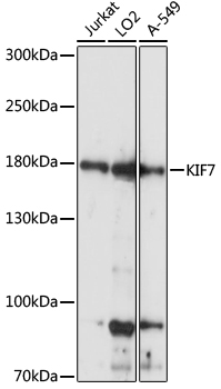 Western blot - KIF7 Polyclonal Antibody 
