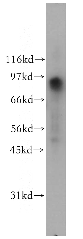 HeLa cells were subjected to SDS PAGE followed by western blot with Catalog No:110753(FXR2 antibody) at dilution of 1:500