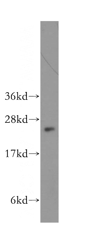human liver tissue were subjected to SDS PAGE followed by western blot with Catalog No:108144(ARL5B antibody) at dilution of 1:500