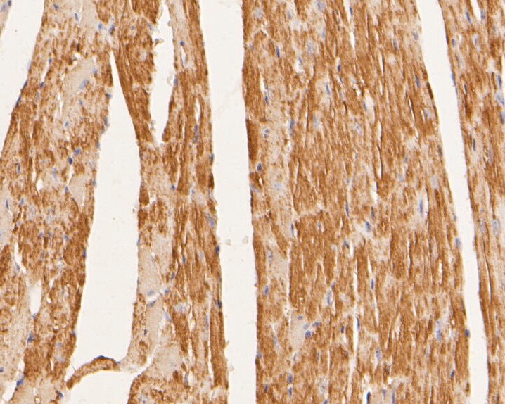 Fig3:; Immunohistochemical analysis of paraffin-embedded mouse heart tissue using anti-SYNDIG1 antibody. The section was pre-treated using heat mediated antigen retrieval with Tris-EDTA buffer (pH 8.0-8.4) for 20 minutes.The tissues were blocked in 5% BSA for 30 minutes at room temperature, washed with ddH; 2; O and PBS, and then probed with the primary antibody ( 1/200) for 30 minutes at room temperature. The detection was performed using an HRP conjugated compact polymer system. DAB was used as the chromogen. Tissues were counterstained with hematoxylin and mounted with DPX.