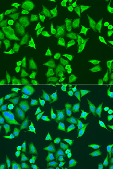 Immunofluorescence - SMN2 Polyclonal Antibody 