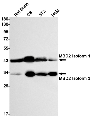 Western blot detection of MBD2 in Rat Brain,C6,3T3,Hela cell lysates using MBD2 Rabbit mAb(1:1000 diluted).Predicted band size:43kDa.Observed band size:43kDa.