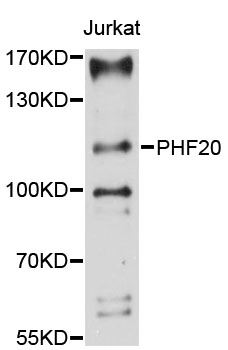 Western blot - PHF20 Polyclonal Antibody 