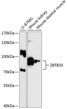 Western blot - ZBTB33 Polyclonal Antibody 