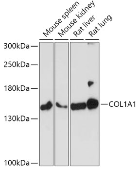 Western blot - COL1A1 Polyclonal Antibody 